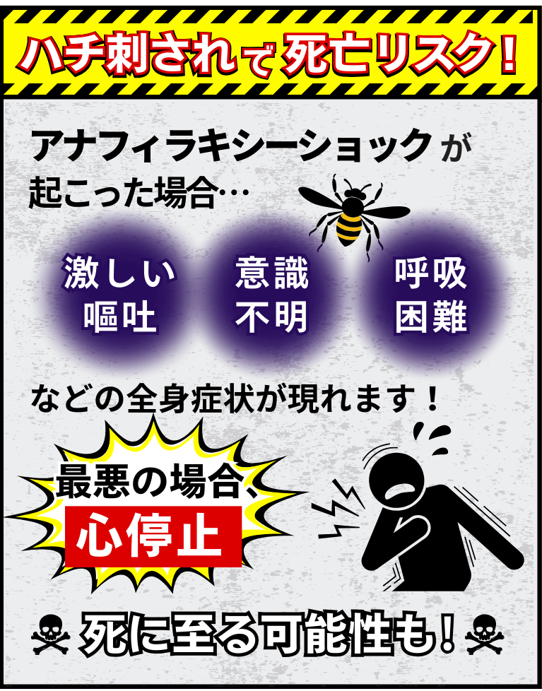 ハチ刺されで死亡リスク！アナフィラキシーショックが起こった場合、最悪の場合心停止が起こり、死に至る可能性も！
