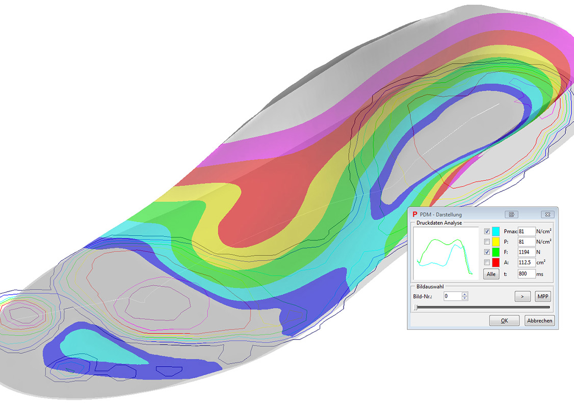 Services pedcad foot technology GmbH